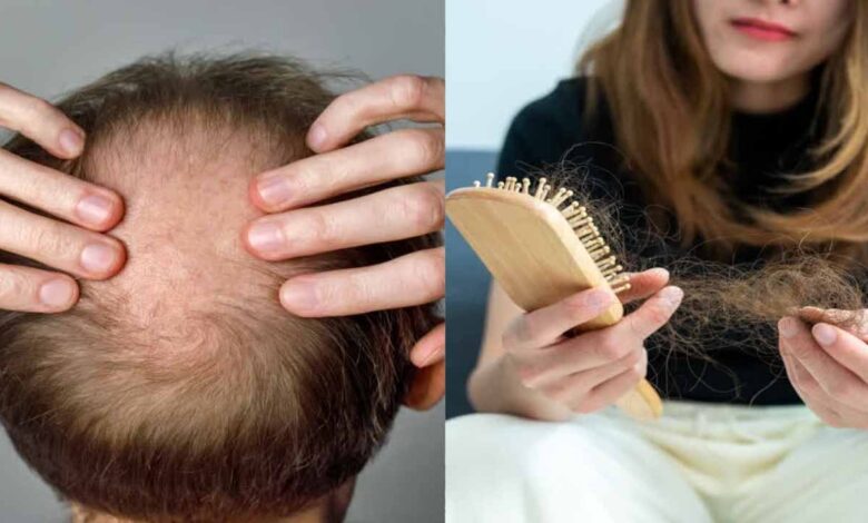 hair Fall